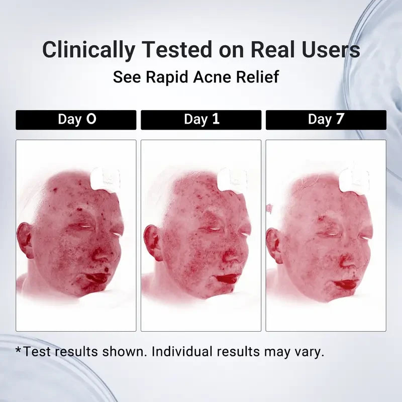 Dr.Leo Salicylic Acid Drying Lotion
